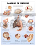 Dangers of Smoking Anatomical Chart